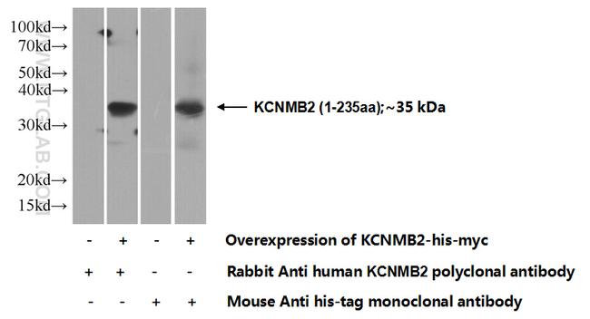 KCNMB2 Antibody in Western Blot (WB)