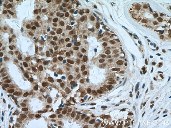 NuMA Antibody in Immunohistochemistry (Paraffin) (IHC (P))