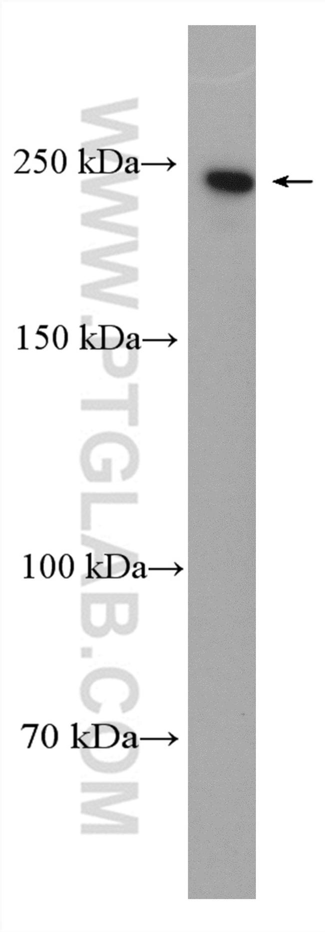 NuMA Antibody in Western Blot (WB)