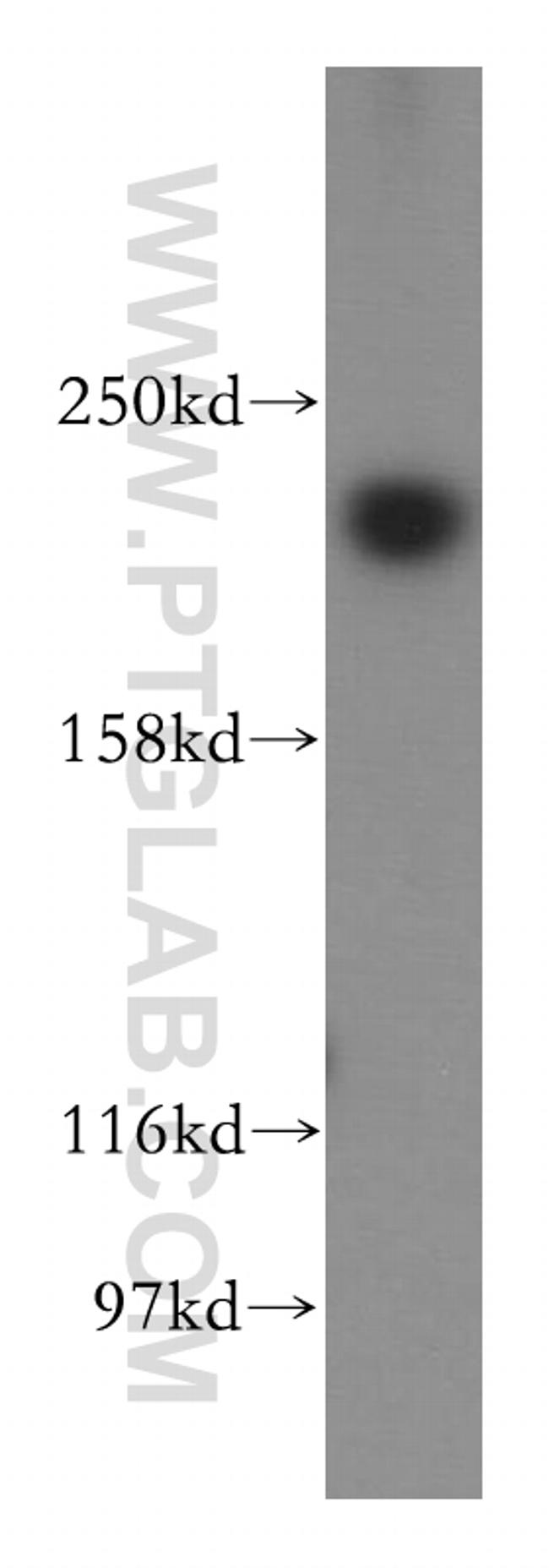 NuMA Antibody in Western Blot (WB)