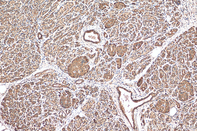 BCL2L13 Antibody in Immunohistochemistry (Paraffin) (IHC (P))