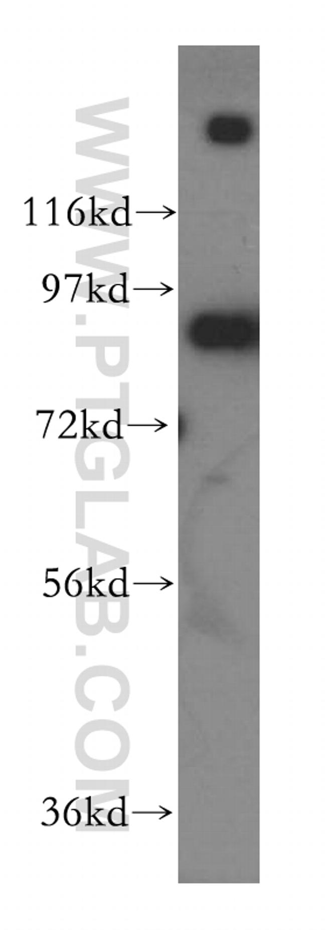 BCL2L13 Antibody in Western Blot (WB)