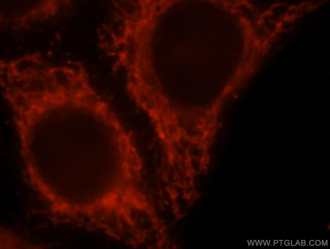 BCL2L13 Antibody in Immunocytochemistry (ICC/IF)