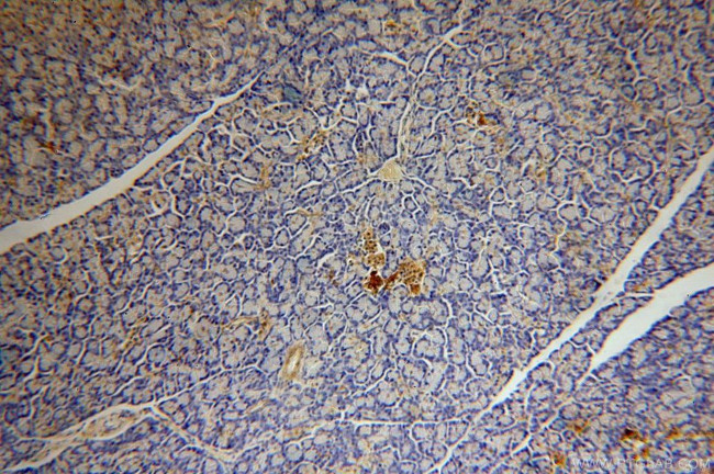 BCL2L13 Antibody in Immunohistochemistry (Paraffin) (IHC (P))