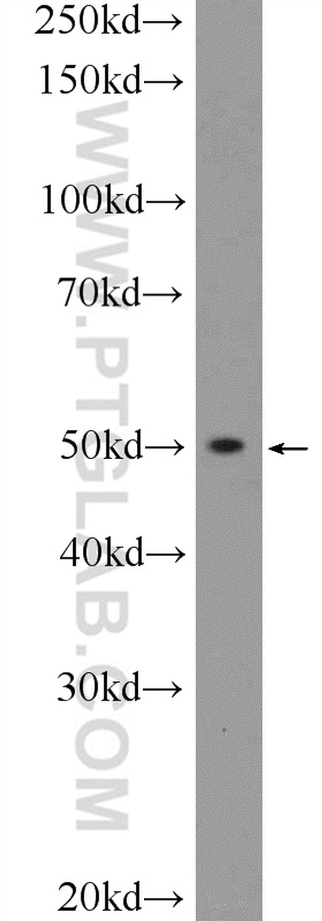 BCL2L13 Antibody in Western Blot (WB)