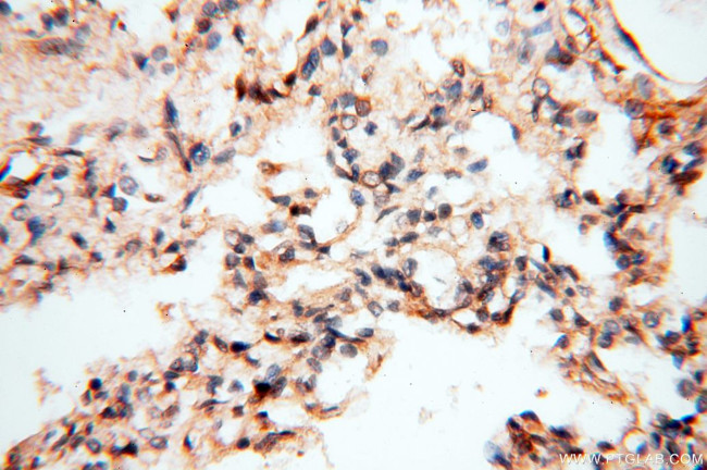 PITPNA Antibody in Immunohistochemistry (Paraffin) (IHC (P))