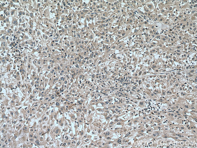 CAD Antibody in Immunohistochemistry (Paraffin) (IHC (P))