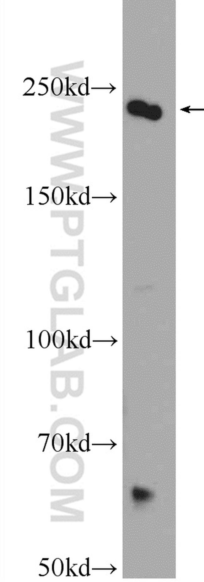 CAD Antibody in Western Blot (WB)