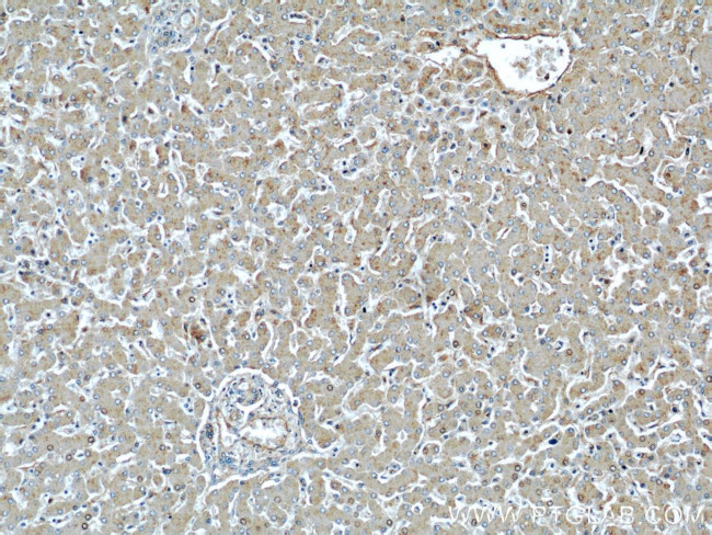 ME1 Antibody in Immunohistochemistry (Paraffin) (IHC (P))