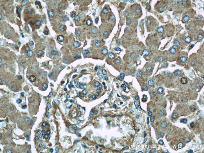 ME1 Antibody in Immunohistochemistry (Paraffin) (IHC (P))