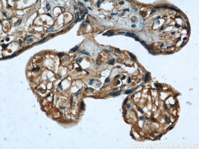 ME1 Antibody in Immunohistochemistry (Paraffin) (IHC (P))