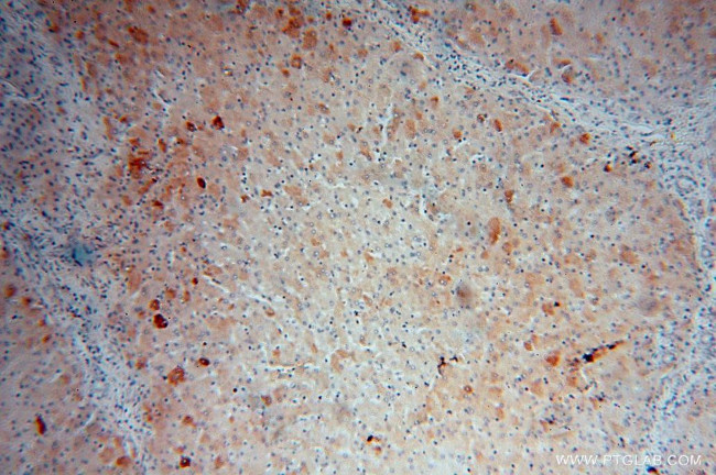 ME1 Antibody in Immunohistochemistry (Paraffin) (IHC (P))