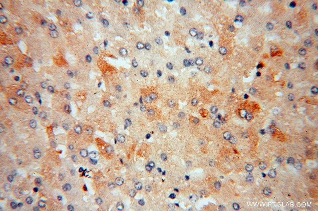 ME1 Antibody in Immunohistochemistry (Paraffin) (IHC (P))