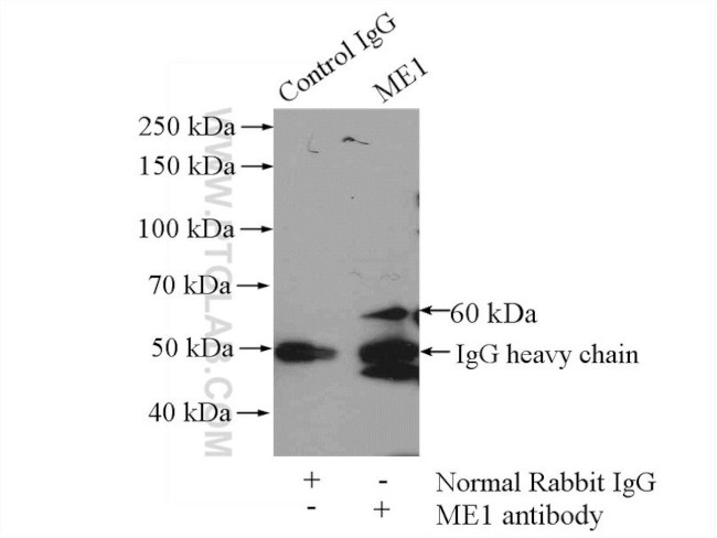 ME1 Antibody in Immunoprecipitation (IP)