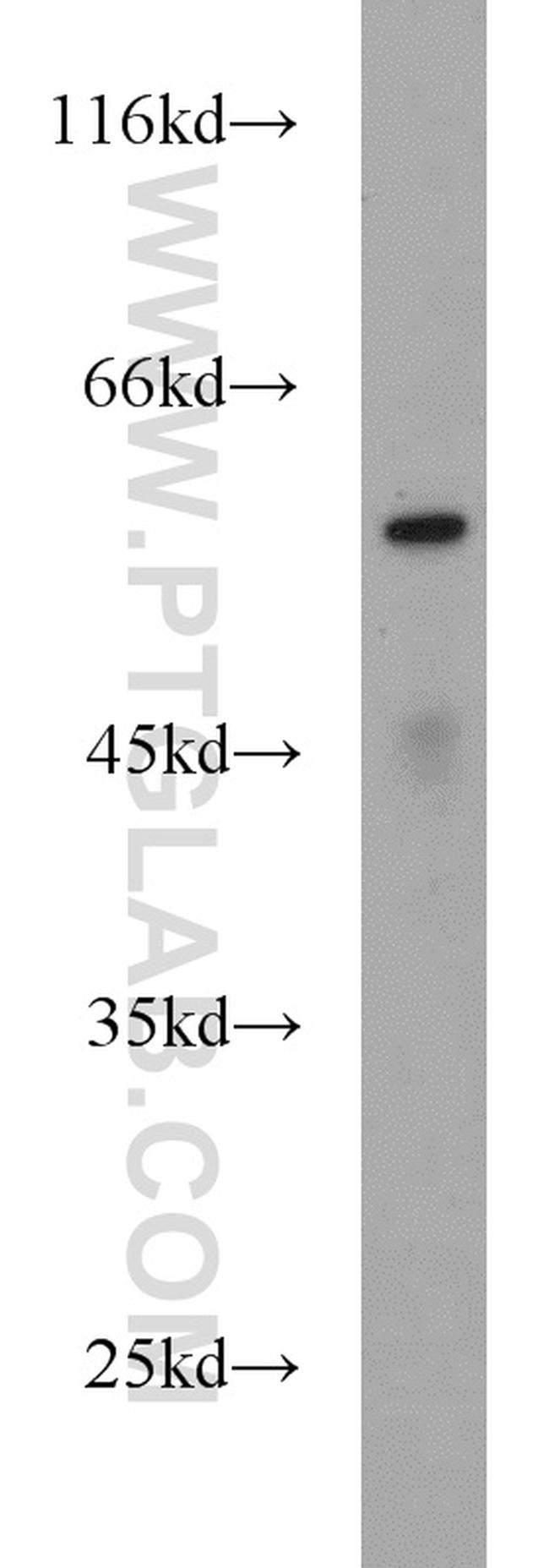 ME1 Antibody in Western Blot (WB)