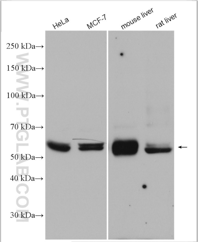 ME1 Antibody in Western Blot (WB)