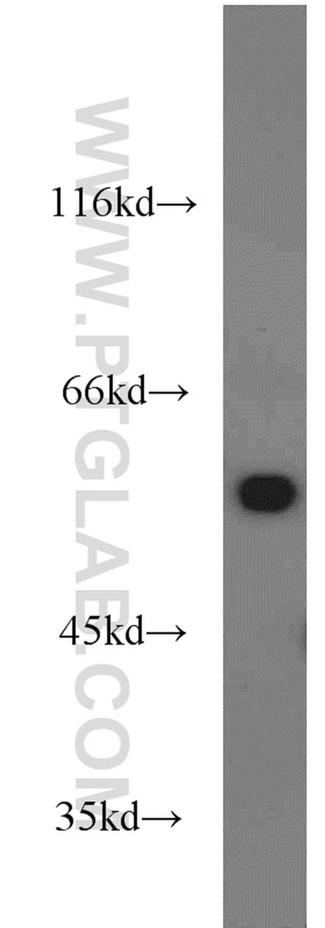 ME1 Antibody in Western Blot (WB)