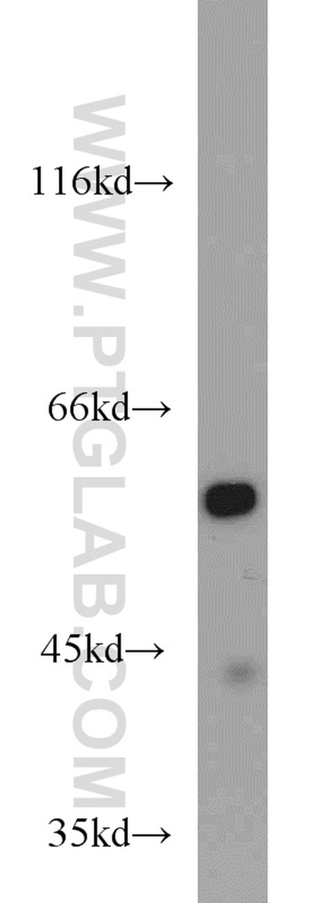 ME1 Antibody in Western Blot (WB)