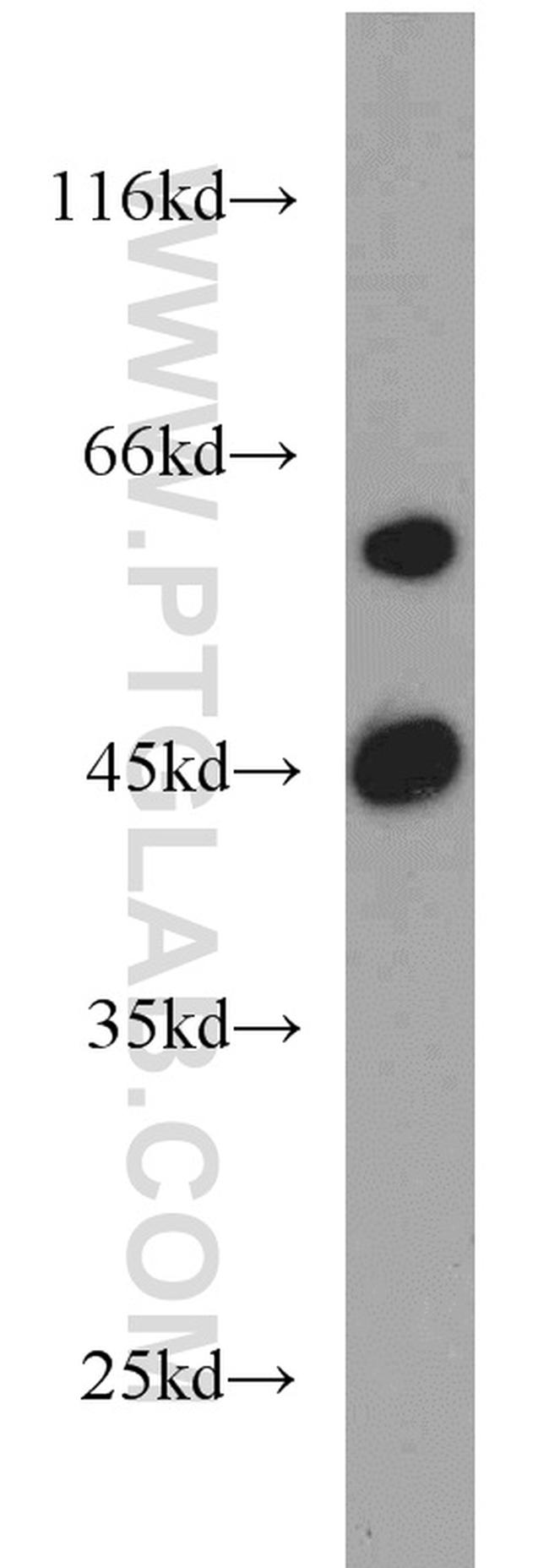 ME1 Antibody in Western Blot (WB)