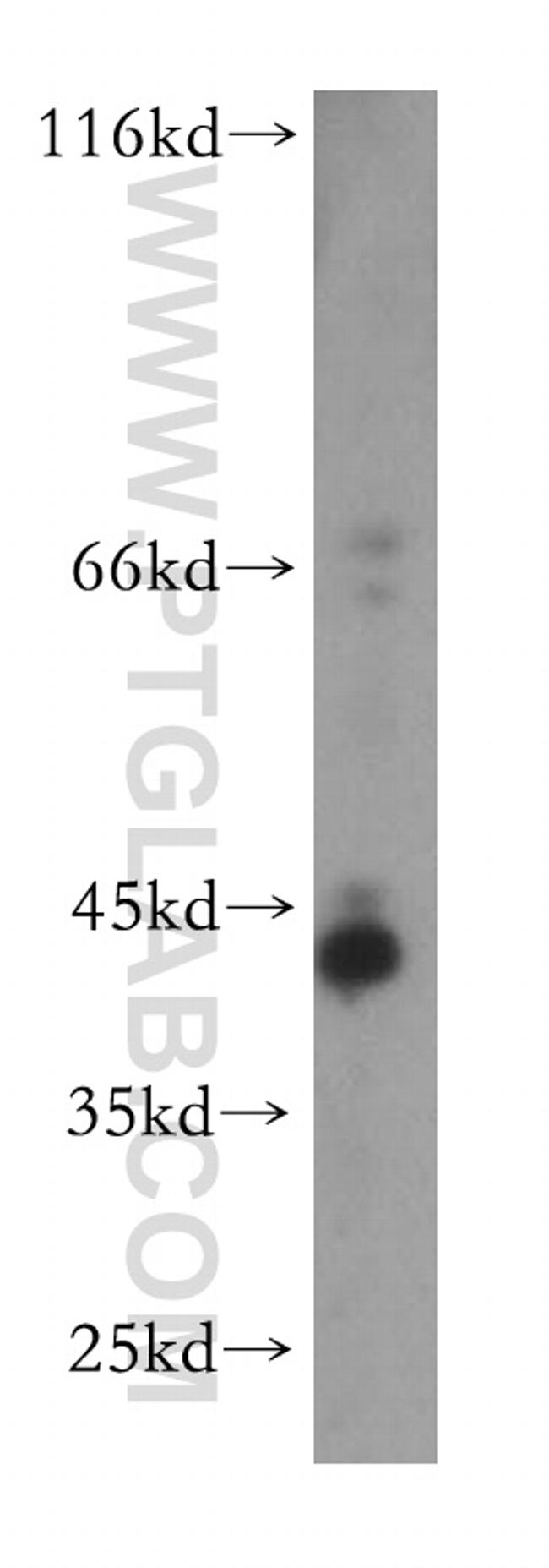 TMLHE Antibody in Western Blot (WB)