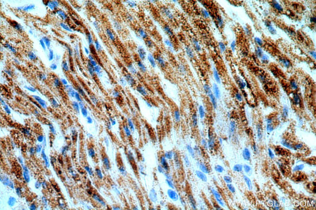 ACADS Antibody in Immunohistochemistry (Paraffin) (IHC (P))