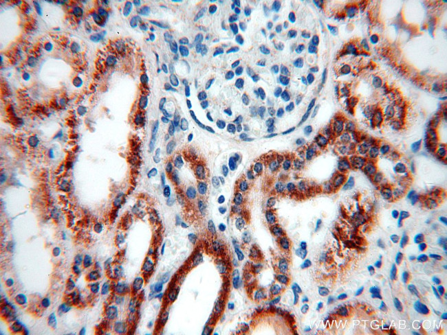 ACADS Antibody in Immunohistochemistry (Paraffin) (IHC (P))