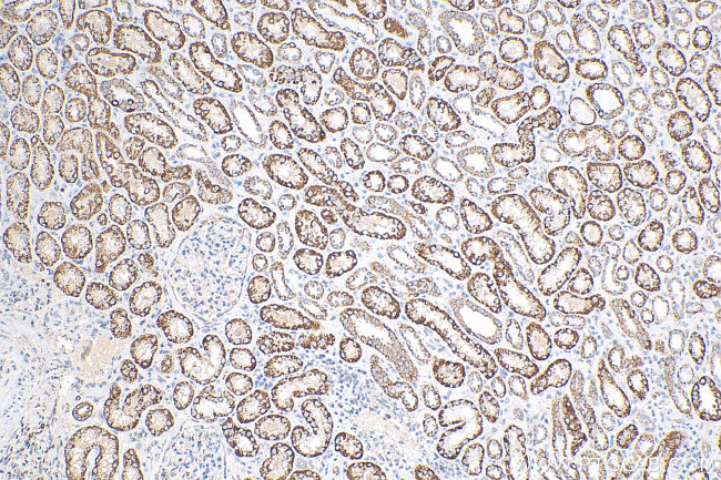 ACADS Antibody in Immunohistochemistry (Paraffin) (IHC (P))