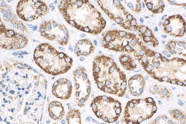 ACADS Antibody in Immunohistochemistry (Paraffin) (IHC (P))