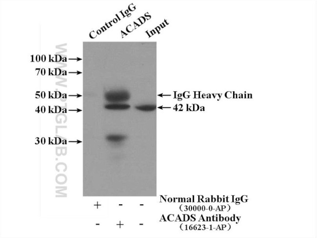 ACADS Antibody in Immunoprecipitation (IP)