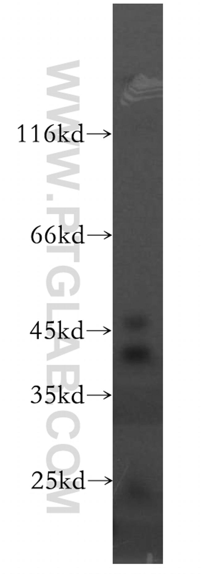 ACADS Antibody in Western Blot (WB)