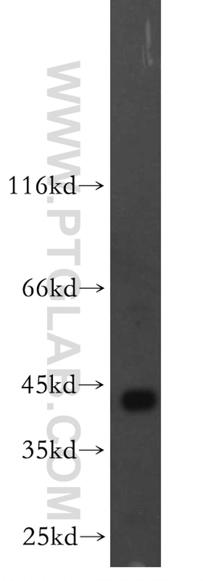 ACADS Antibody in Western Blot (WB)