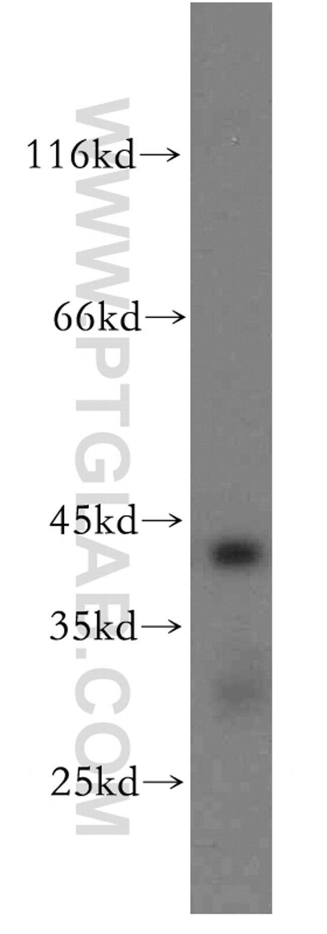 ACADS Antibody in Western Blot (WB)