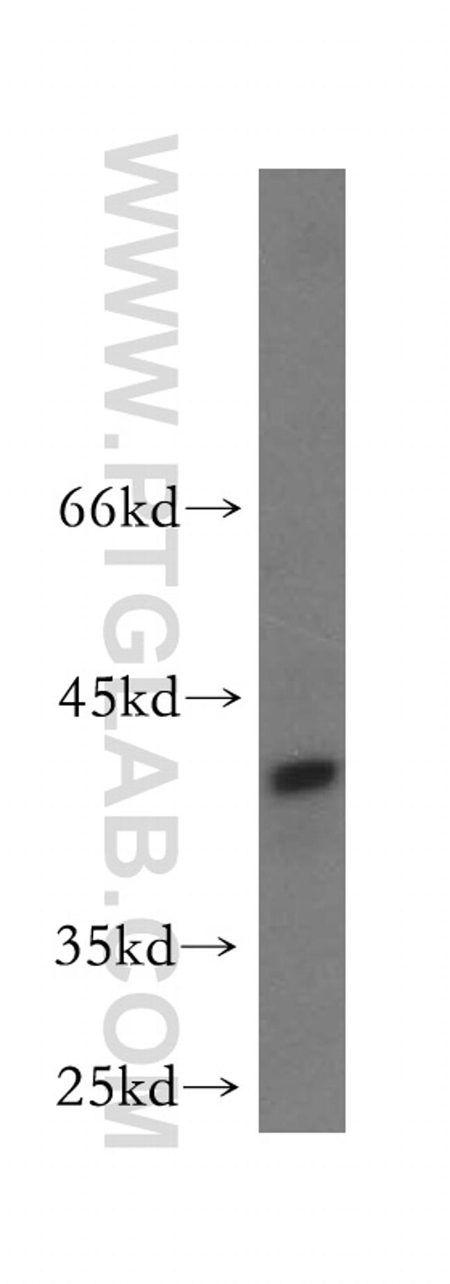 HOMER3 Antibody in Western Blot (WB)