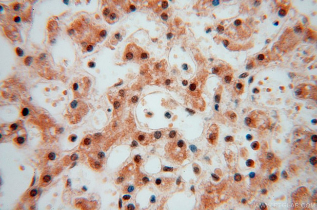 COPS7A Antibody in Immunohistochemistry (Paraffin) (IHC (P))