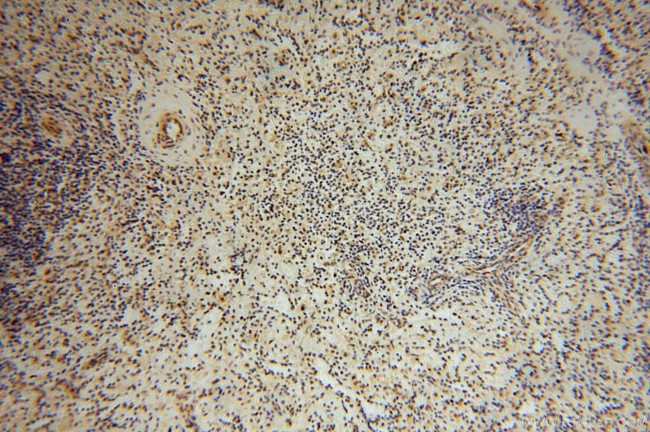 COPS7A Antibody in Immunohistochemistry (Paraffin) (IHC (P))