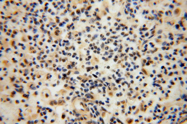 COPS7A Antibody in Immunohistochemistry (Paraffin) (IHC (P))