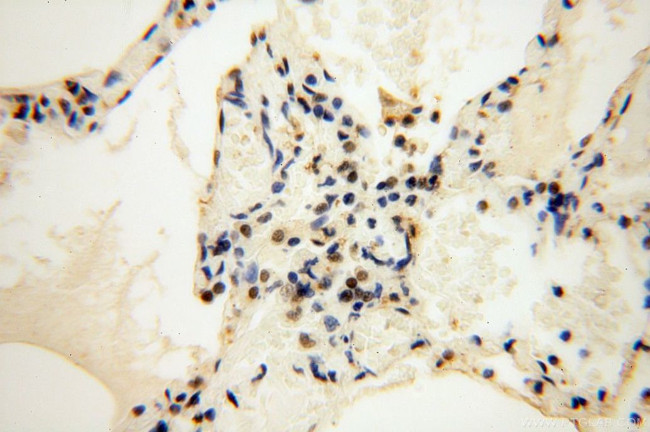 COPS7A Antibody in Immunohistochemistry (Paraffin) (IHC (P))