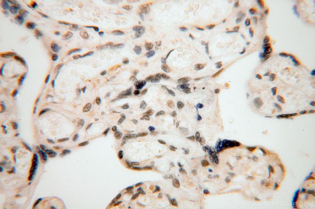 COPS7A Antibody in Immunohistochemistry (Paraffin) (IHC (P))