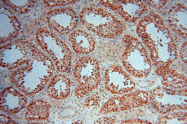 COPS7A Antibody in Immunohistochemistry (Paraffin) (IHC (P))