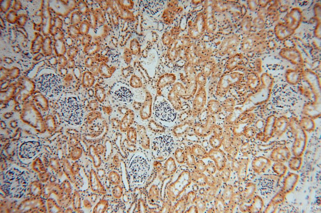 COPS7A Antibody in Immunohistochemistry (Paraffin) (IHC (P))