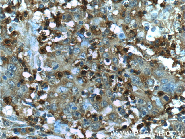 S100A12 Antibody in Immunohistochemistry (Paraffin) (IHC (P))