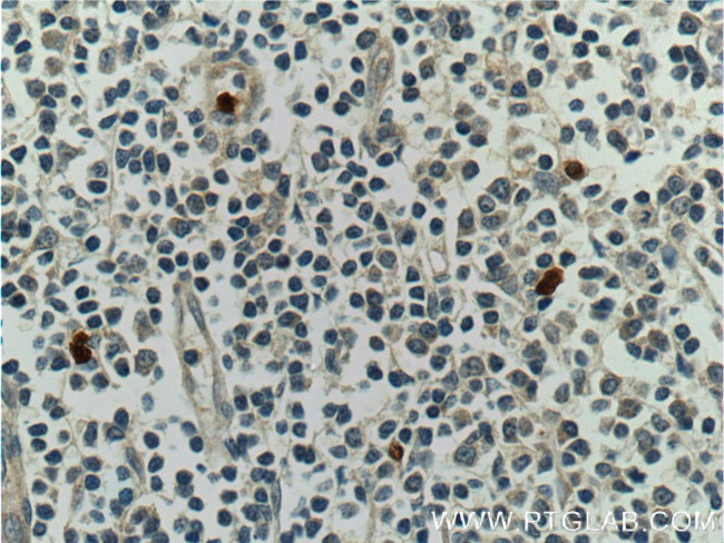 S100A12 Antibody in Immunohistochemistry (Paraffin) (IHC (P))