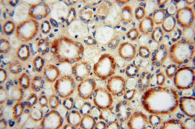 OCIAD1 Antibody in Immunohistochemistry (Paraffin) (IHC (P))