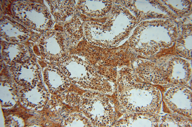 OCIAD1 Antibody in Immunohistochemistry (Paraffin) (IHC (P))