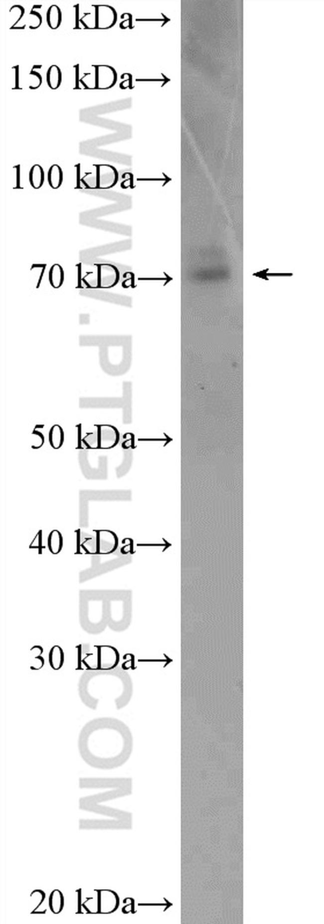 CCDC22 Antibody in Western Blot (WB)