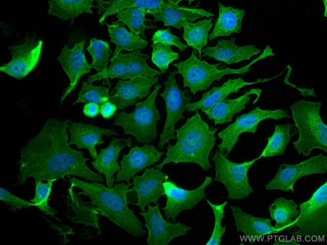 AHNAK Antibody in Immunocytochemistry (ICC/IF)