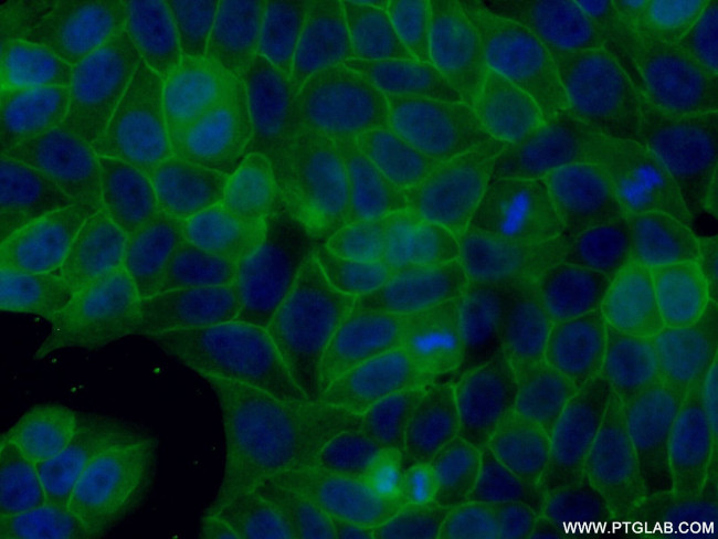 AHNAK Antibody in Immunocytochemistry (ICC/IF)