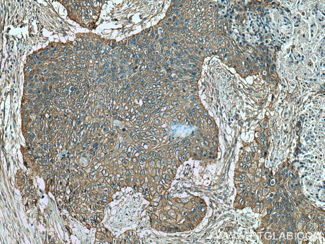 AHNAK Antibody in Immunohistochemistry (Paraffin) (IHC (P))