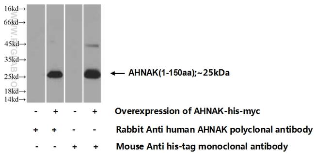 AHNAK Antibody in Western Blot (WB)