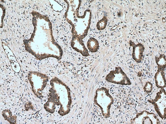 EPLIN Antibody in Immunohistochemistry (Paraffin) (IHC (P))